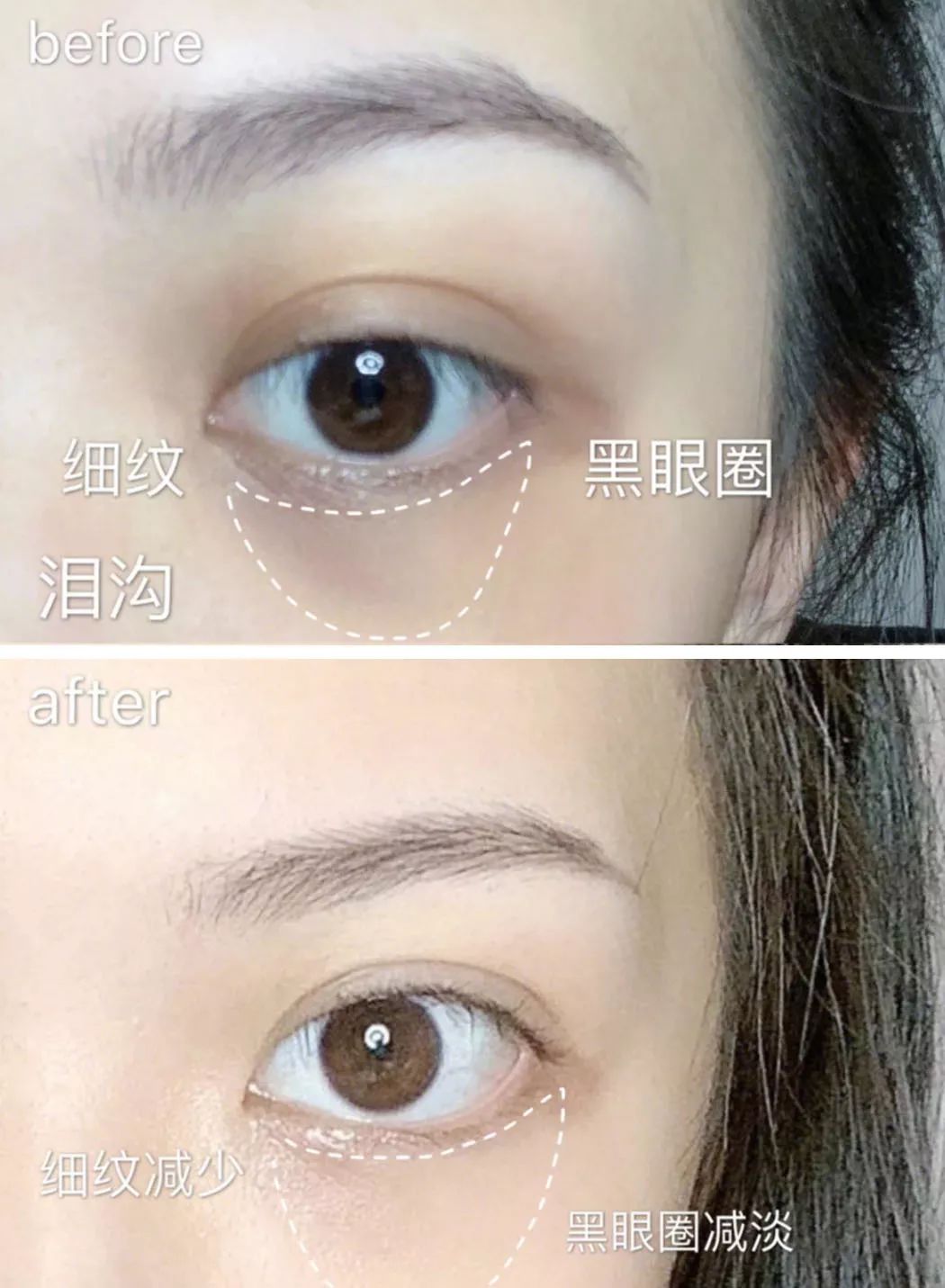 眼膜贴八小时紧致抗皱淡细纹,官方眼膜紧致抗皱淡细纹法令纹