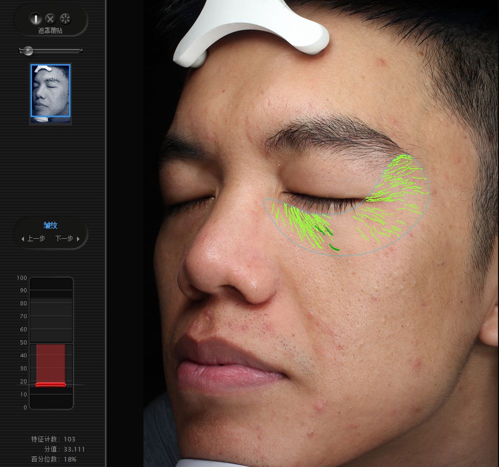 五周年福利｜皮肤“照妖镜”VISIA免费体验！定制你的皮肤管理方案，浙大四院五周年福利持续放送中