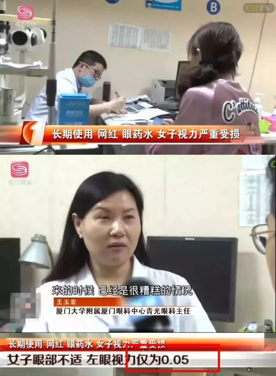 警惕！网红眼药水用了几个月，厦门一“手游”女青年竟患上干眼症