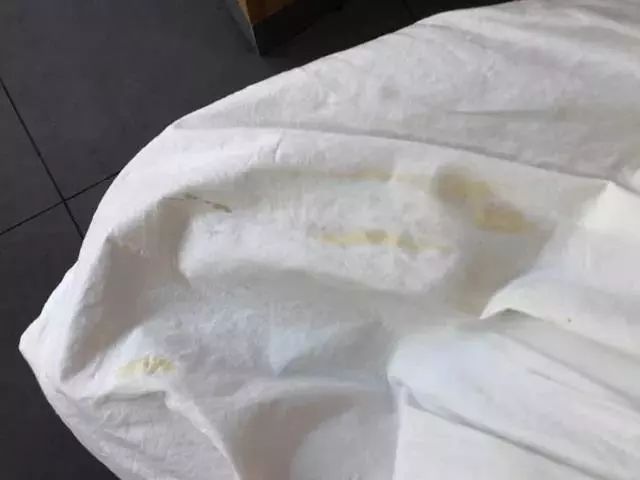 夏天来了衣服上潮湿有霉斑怎么办,衣服发霉了怎么洗掉霉斑小妙招