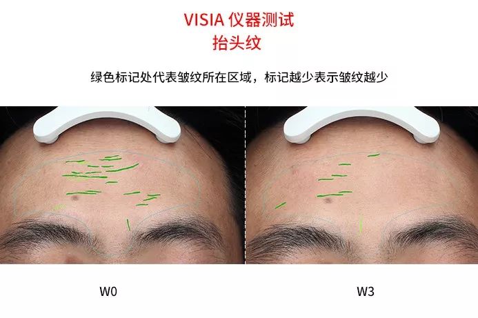 同样的年龄有的年轻人有的人老,同样的年龄为何他却比你显得年轻