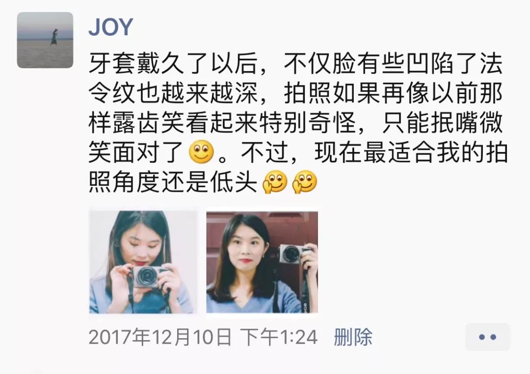 戴牙套改变了脸型可以恢复吗,戴牙套改变颜值