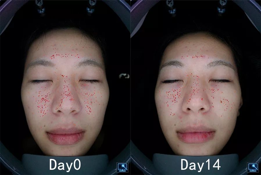 盲测|微整不急!先试试黑科技抗老面霜