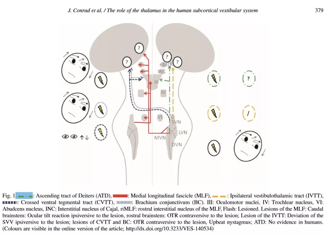 耳石症眩晕手法视频,耳石症头晕怎么训练