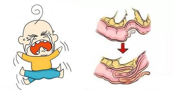 八个月女宝宝有异味,女婴身上味道很难闻