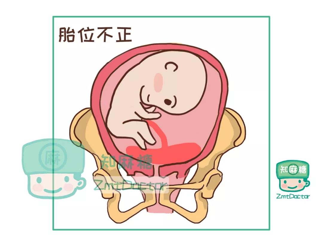 给孕妈妈最好的礼物是什么,给孕妇妈妈的实用的礼物