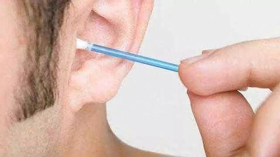 耳垢要不要掏呢,耳垢能用手掏吗