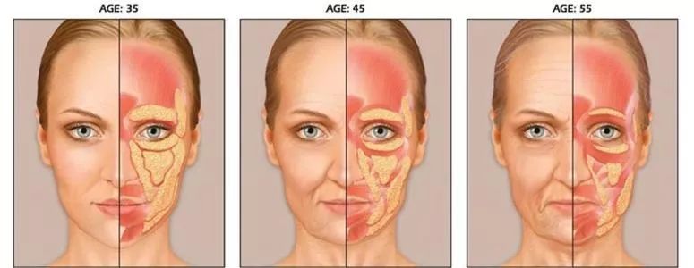 眼霜是交智商税,智商税护肤品眼霜