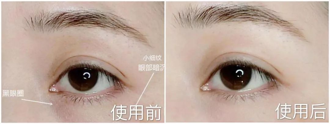 资生堂适合40岁以上的抗皱系列,资生堂抗衰老抗皱纹