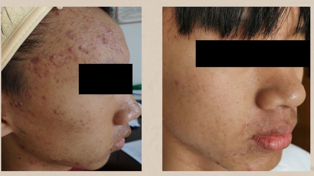 蒙自第一人民医院中医科,蒙自市中医院专家门诊