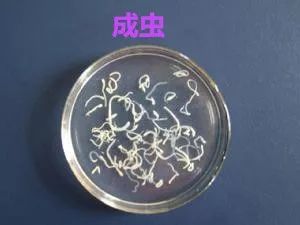 屁股里面痒是蛔虫还是蛲虫,宝宝屁屁疼是不是有虫