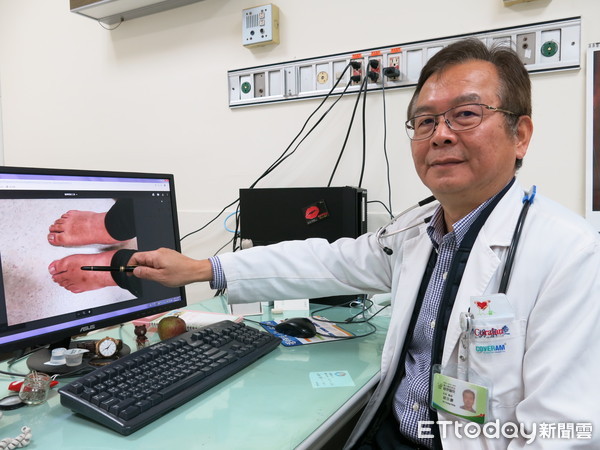 生日变调！27岁女连吃5天火锅脚趾爆肿，痛到失眠　医：这汤别喝