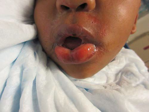 幼儿误食矿物干燥剂要洗胃吗,孩子吃了干燥剂需要洗胃吗