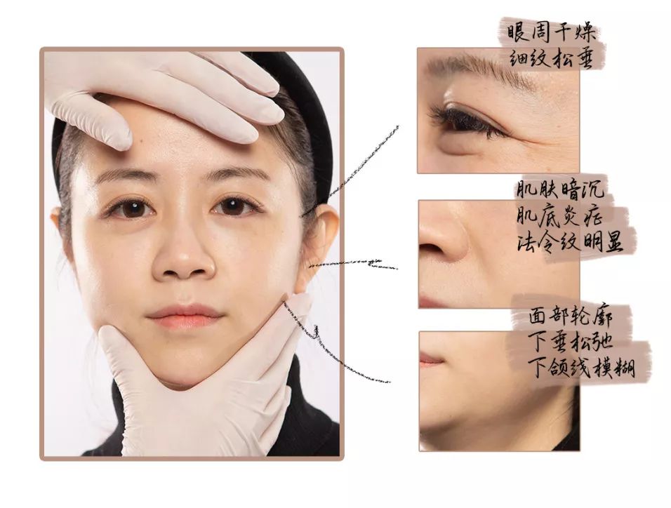 地表最强修复肌肤屏障,地表最强肌诊室