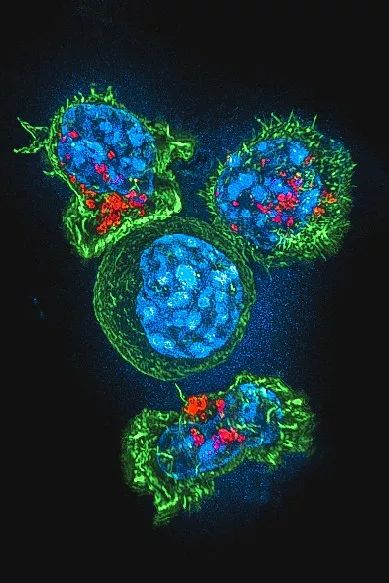 鍋囧鐥呮瘨鎰熸煋浜嗘垜,鍋囧鐥呮瘨鎰熸煋浜嗕綘