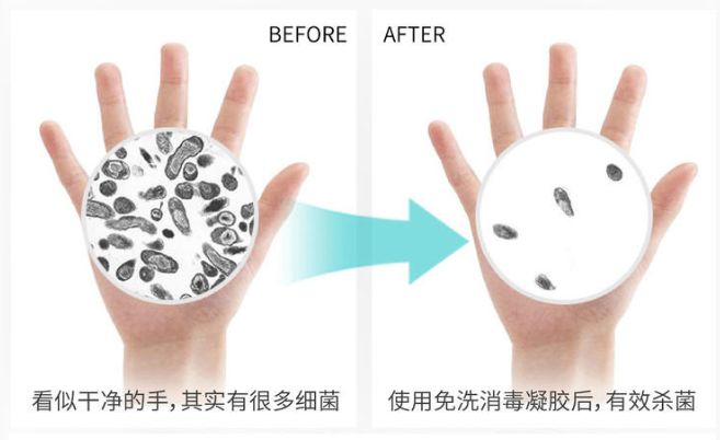 消毒凝胶免手洗医院同款,医院专用消毒凝胶免洗