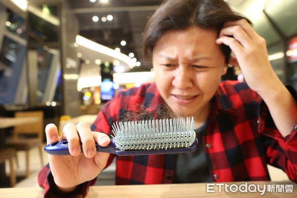 产后掉发超崩溃!她头发脱落白肉浮现 专家授6招改善:少吃生蛋白