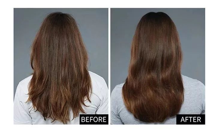 头上又油又有头皮屑又痒怎么办,头上又痒又油有头屑