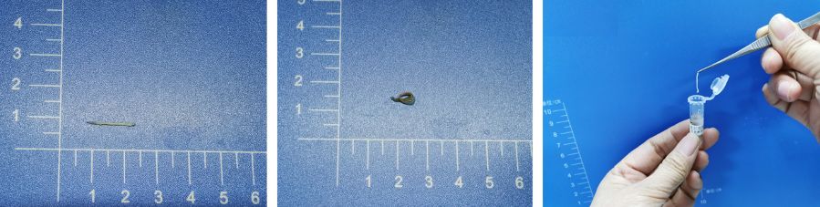 2020年淋巴瘤病理诊断必备知识点,淋巴瘤病理质控