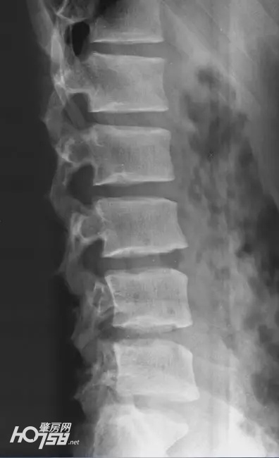 航天级无创体检仪登陆肇庆院子，1分钟告别亚健康