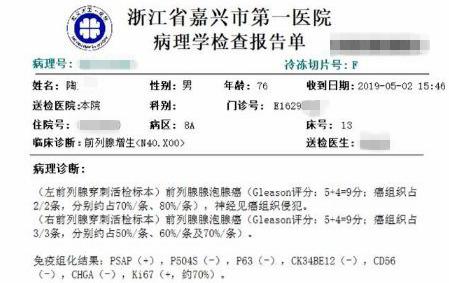 高危型mhv阳性,高危阳性tct非典型鳞状上皮病变