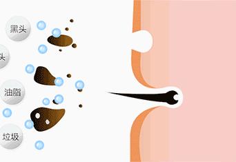 洗出脸上的脏东西解压,清除脸上斑块的产品