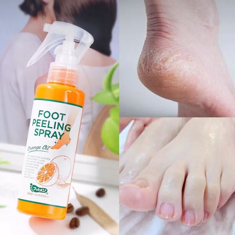 美脚神器哪个效果最好,美脚神器去角质呵护足底