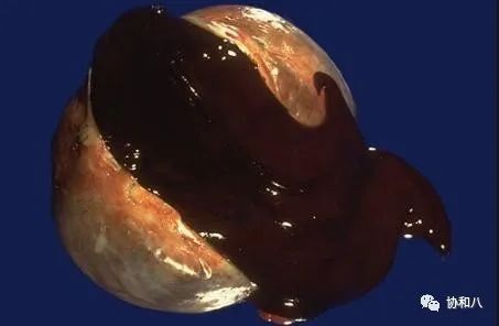 复习这些名解时总觉得怪饿的|协和八·脑洞大开