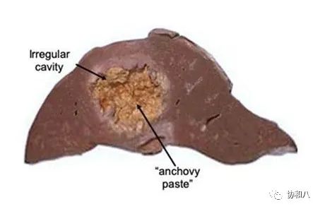 复习这些名解时总觉得怪饿的|协和八·脑洞大开