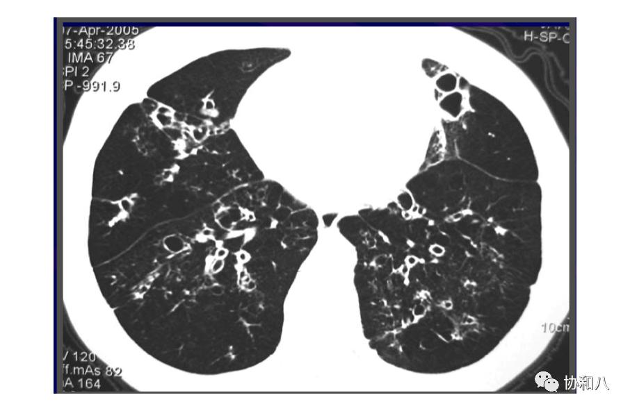 复习这些名解时总觉得怪饿的|协和八·脑洞大开