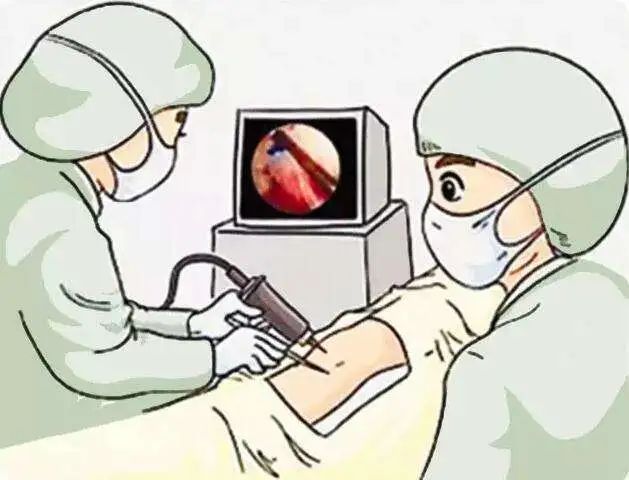 肩关节疾病的微创关节镜治疗,骨科肩关节微创