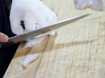 女子体内取出活虫只因爱吃这套菜,女子体内取出活虫只因爱吃这样菜