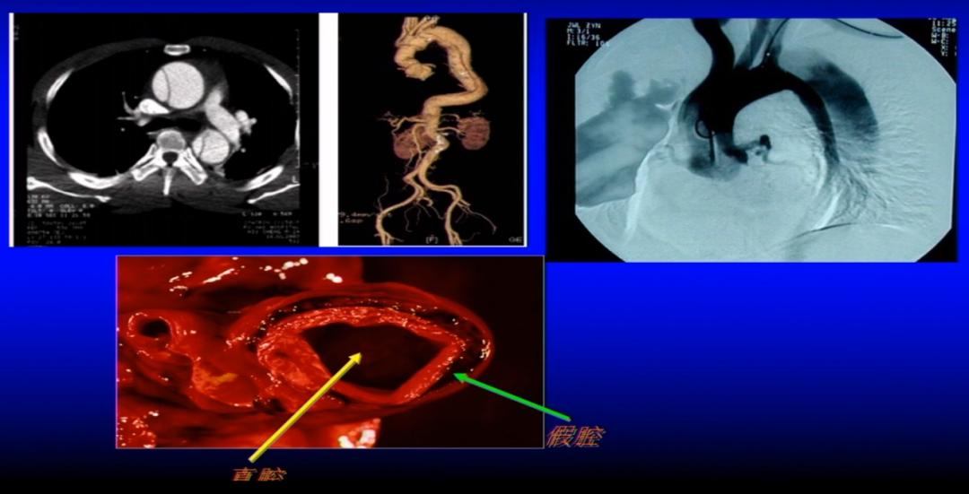 胸痛的诊断与鉴别诊断心得,急性胸痛的诊断思路和方法