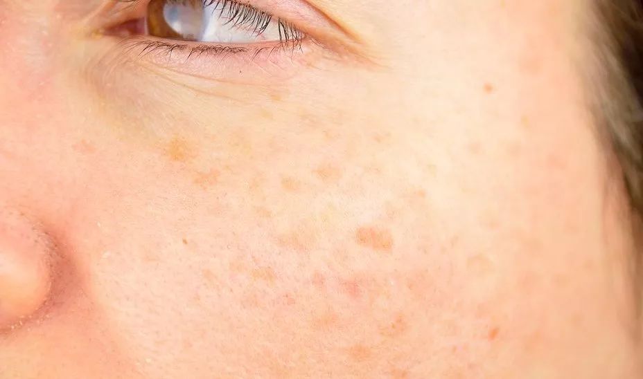 扔掉没用的捂脸布!360°“V”脸的它才是王道