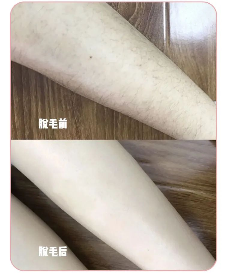 不含芦荟的脱毛膏,猕猴桃脱毛膏排行榜