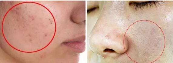 洗出脸上的脏东西解压,清除脸上斑块的产品