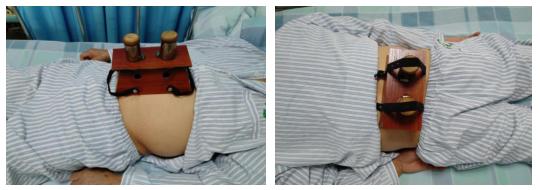 针灸治疗尿不出穴位图,小便次数多针灸疗法