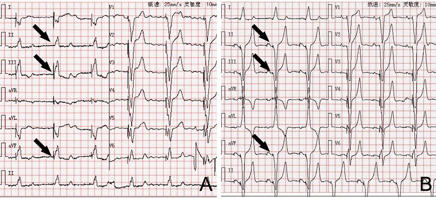 “绿宝书”丨精美图谱，生动形象！换个方式看心脏解剖（2）