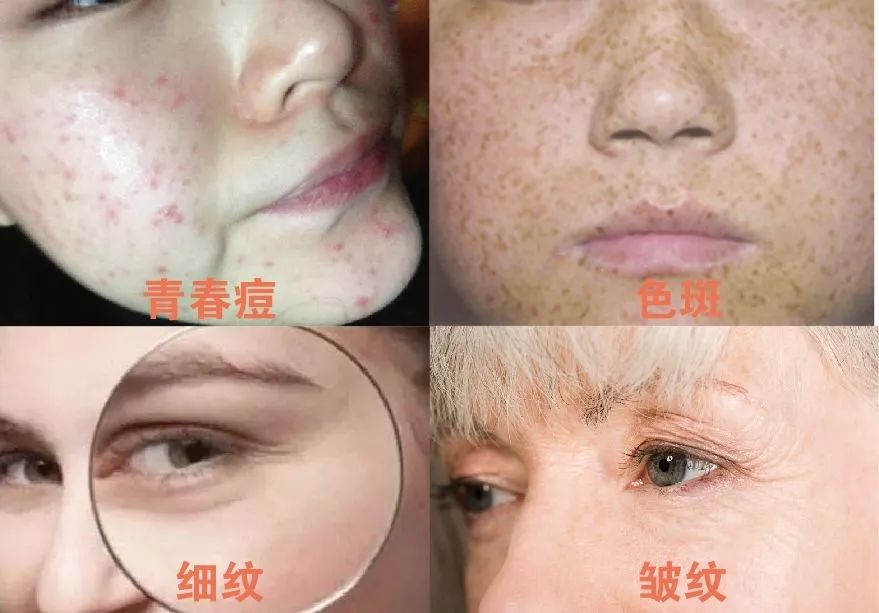 喝胶原蛋白要坚持多久才能有效果,紧急提醒经常喝这个的人要注意了