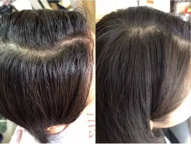 喝胶原蛋白要坚持多久才能有效果,紧急提醒经常喝这个的人要注意了