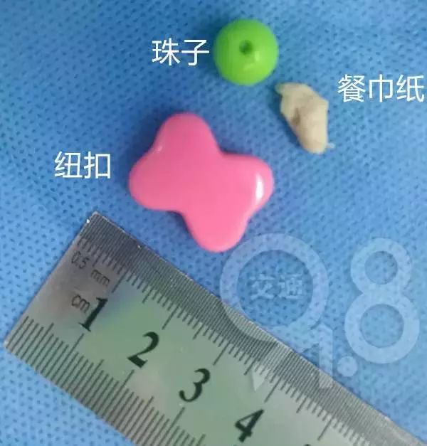 1岁女童染上怪病,1岁女孩不幸染上怪病