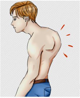 健康科普|甘肃省中医院小儿骨二科开展青少年脊柱侧弯矫形相关项目