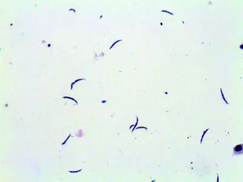 尿液有形成分检查,尿液中检测到的有形成分有哪些