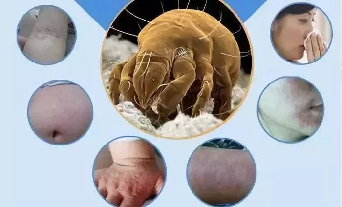 用什么洗脸抑制螨虫生长,用什么洗脸可以抑制螨虫生长