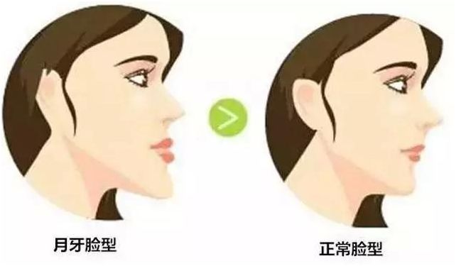 矫正牙齿的最佳年龄和价格表,孩子矫正牙齿多大年龄最合适