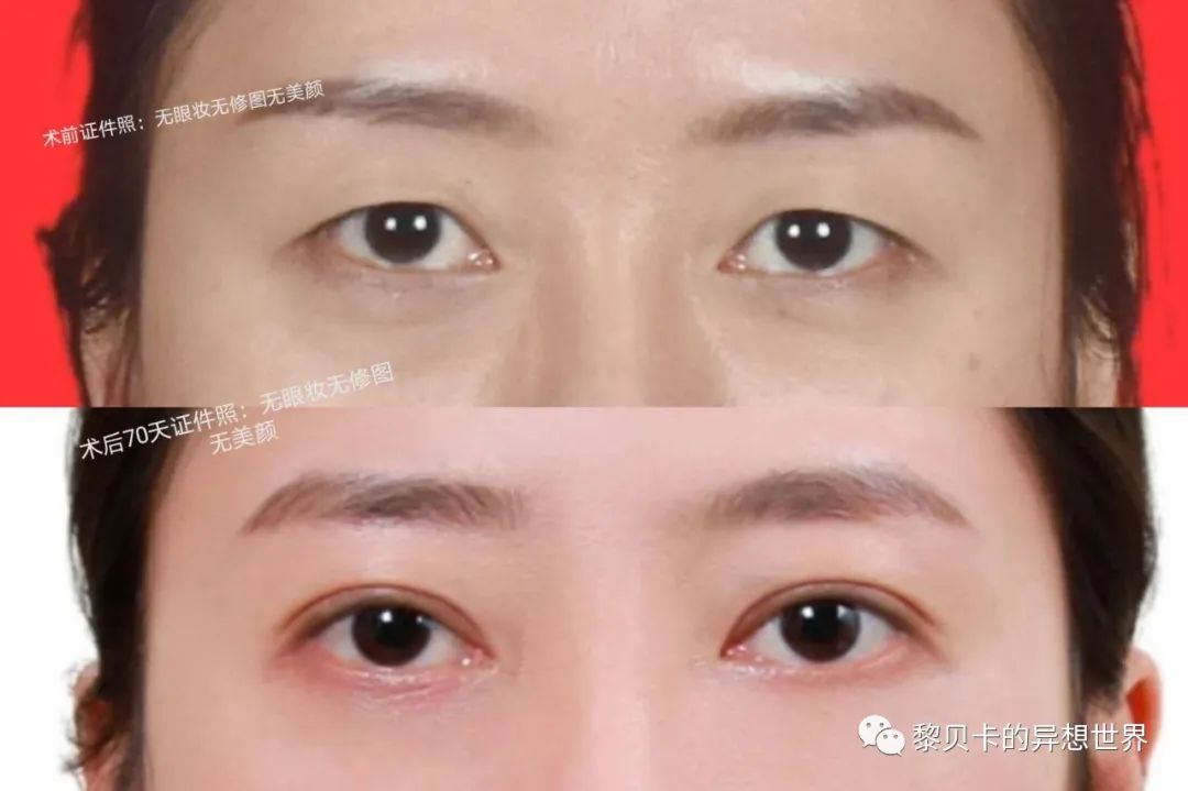 做完医美用可复美吗,你知道做完医美有多可怕