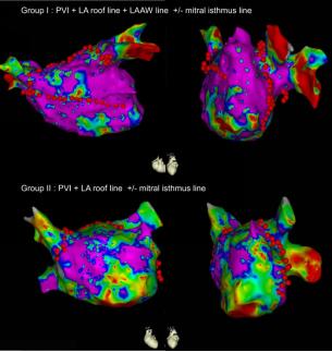心导管射频消融术治疗房颤,房颤射频治疗