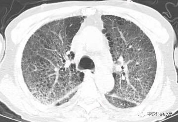 输盐水的目的,生病输盐水有什么用