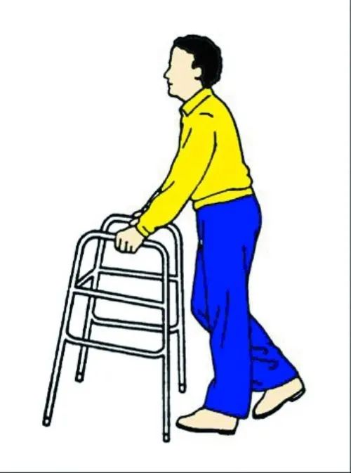 骨折后如何康复治疗？《祝您健康》昭通市中医医院付明超医生为您支招