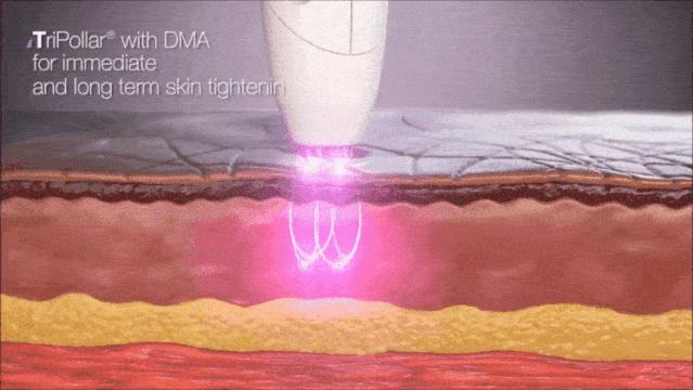 推广｜|下半年想买的第一个大件，我推荐它